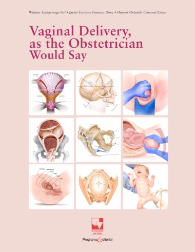 Vaginal Delivery, as the Obstetrician Would Say
