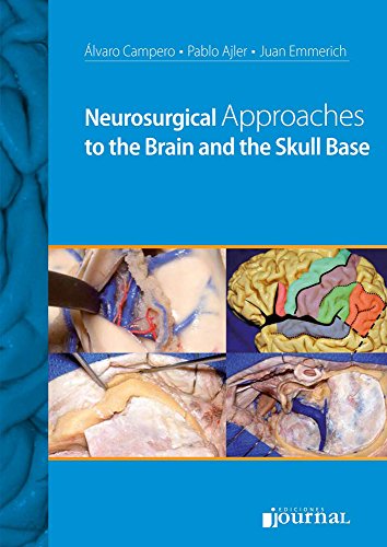 Neurosurgical Approaches to the Brain and the Skull Base